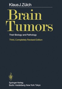 Bild: Brain Tumors - Springer