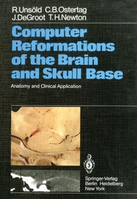 Abbildung von: Computer Reformations of the Brain and Skull Base - Springer