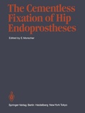 Cover: The Cementless Fixation of Hip Endoprostheses - Springer