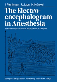 Abbildung von: The Electroencephalogram in Anesthesia - Springer