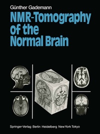 Abbildung von: NMR-Tomography of the Normal Brain - Springer