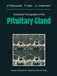 Abbildung von: Computed Tomography of the Pituitary Gland - Springer