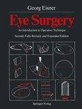 Cover: Eye Surgery - Springer