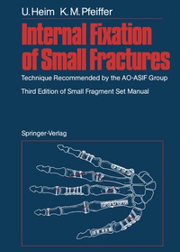 Enlarge image Cover: Internal Fixation of Small Fractures - Springer