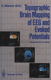 Bild: Topographic Brain Mapping of EEG and Evoked Potentials - Springer