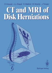 Abbildung von: CT and MRI of Disk Herniations - Springer