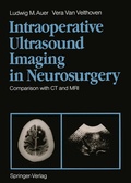 Bild: Intraoperative Ultrasound Imaging in Neurosurgery - Springer