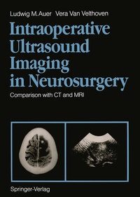 Bild: Intraoperative Ultrasound Imaging in Neurosurgery - Springer