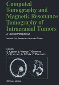 Bild: Computed Tomography and Magnetic Resonance Tomography of Intracranial Tumors - Springer
