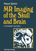 Bild: MR Imaging of the Skull and Brain - Springer