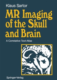 Bild: MR Imaging of the Skull and Brain - Springer