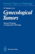 Cover: Gynecological Tumors - Springer