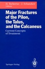 Cover: Major Fractures of the Pilon, the Talus, and the Calcaneus - Springer