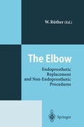 Cover: The Elbow - Springer