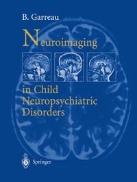 Abbildung von: Neuroimaging in child neuropsychiatric disorders - Springer