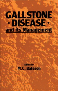 Abbildung von: Gallstone Disease and its Management - Springer