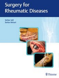 Enlarge image Cover: Surgery for Rheumatic Diseases - Thieme