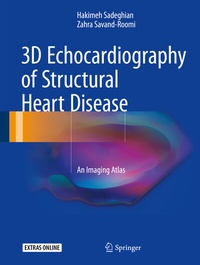 Abbildung von: 3D Echocardiography of Structural Heart Disease - Springer