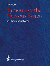 Bild: Tumours of the Nervous System - Springer