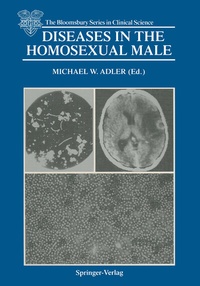 Abbildung von: Diseases in the Homosexual Male - Springer
