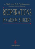 Bild: Reoperations in Cardiac Surgery - Springer