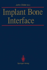 Abbildung von: Implant Bone Interface - Springer