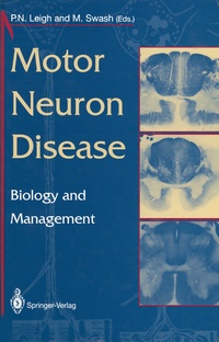 Abbildung von: Motor Neuron Disease - Springer
