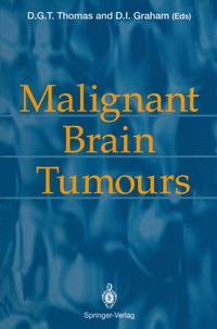 Bild: Malignant Brain Tumours - Springer