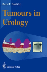 Abbildung von: Tumours in Urology - Springer