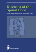 Bild: Diseases of the Spinal Cord - Springer