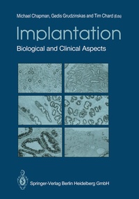 Abbildung von: Implantation - Springer