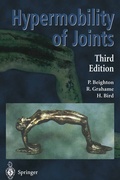 Cover: Hypermobility of Joints - Springer
