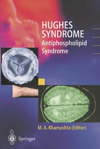 Abbildung von: Hughes Syndrome - Springer
