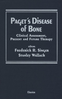 Abbildung von: Paget's Disease of Bone - Springer