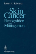 Cover: Skin Cancer - Springer