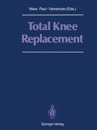 Abbildung von: Total Knee Replacement - Springer