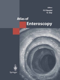Abbildung von: Atlas of Enteroscopy - Springer
