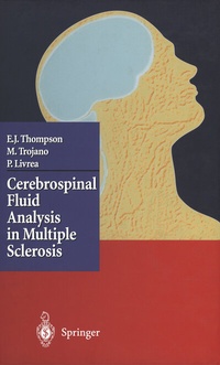 Abbildung von: Cerebrospinal Fluid Analysis in Multiple Sclerosis - Springer