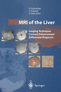 Cover: MRI of the Liver - Springer