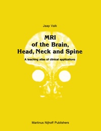 Abbildung von: MRI of the Brain, Head, Neck and Spine - Springer