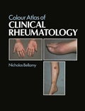 Cover: Colour Atlas of Clinical Rheumatology - Springer