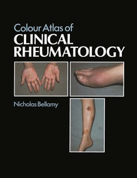 Enlarge image Cover: Colour Atlas of Clinical Rheumatology - Springer