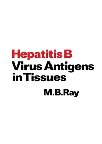Abbildung von: Hepatitis B Virus Antigens in Tissues - Springer