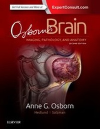 Enlarge image Cover: Osborn's Brain - Elsevier