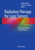 Cover: Radiation Therapy for Liver Tumors - Springer