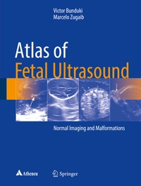 Abbildung von: Atlas of Fetal Ultrasound - Springer