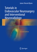 Abbildung von: Tutorials in Endovascular Neurosurgery and Interventional Neuroradiology - Springer