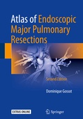 Bild: Atlas of Endoscopic Major Pulmonary Resections - Springer