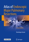 Bild: Atlas of Endoscopic Major Pulmonary Resections - Springer