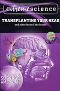 Cover: Extreme Science: Transplanting Your Head - St. Martin's Griffin